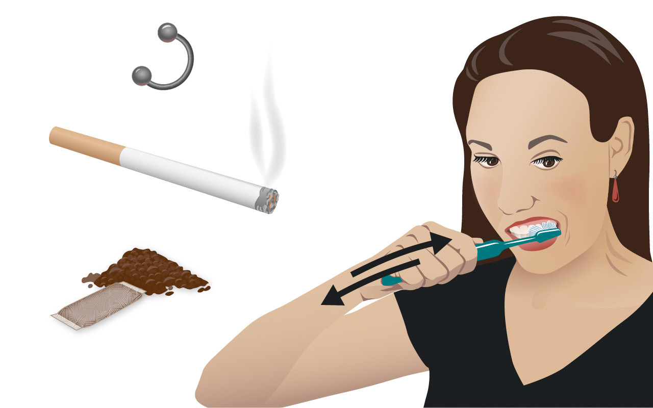 Ursachen der Zahnfleischrezession