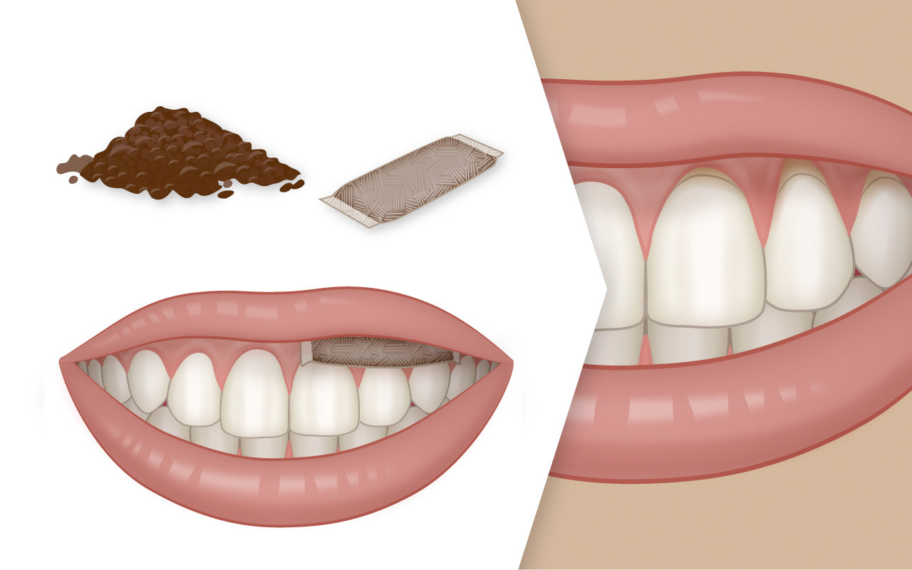 Rauchloser Tabak (Snus)