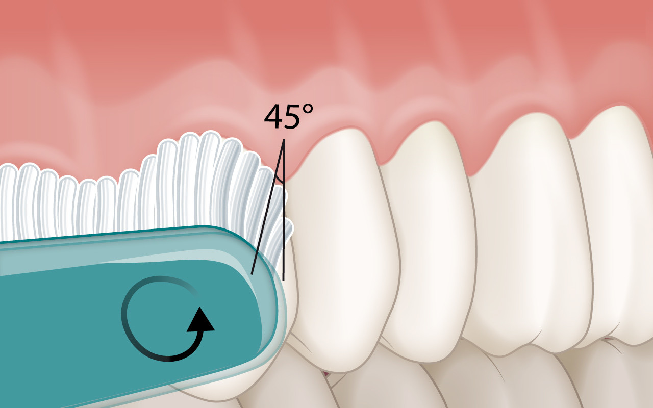 Optimale häusliche Mundhygiene